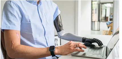Brazo biónico controlado por neurotecnología